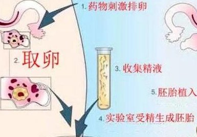 泰国做三代试管婴儿比较好的医院排名，技术比较好