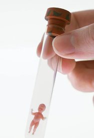 详解朔州做试管成功的条件，5大条件需满足缺一不可